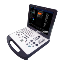 Großhandel Heißer 3D-Farb-Doppler-Ultraschall des CE-Standards
